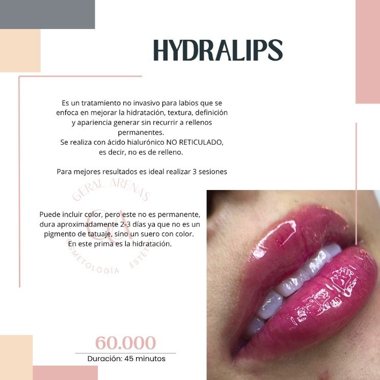 Hidralips