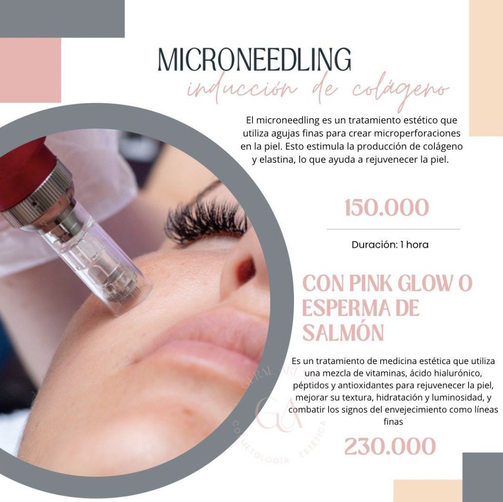 Inducción de Colágeno · Microneedling