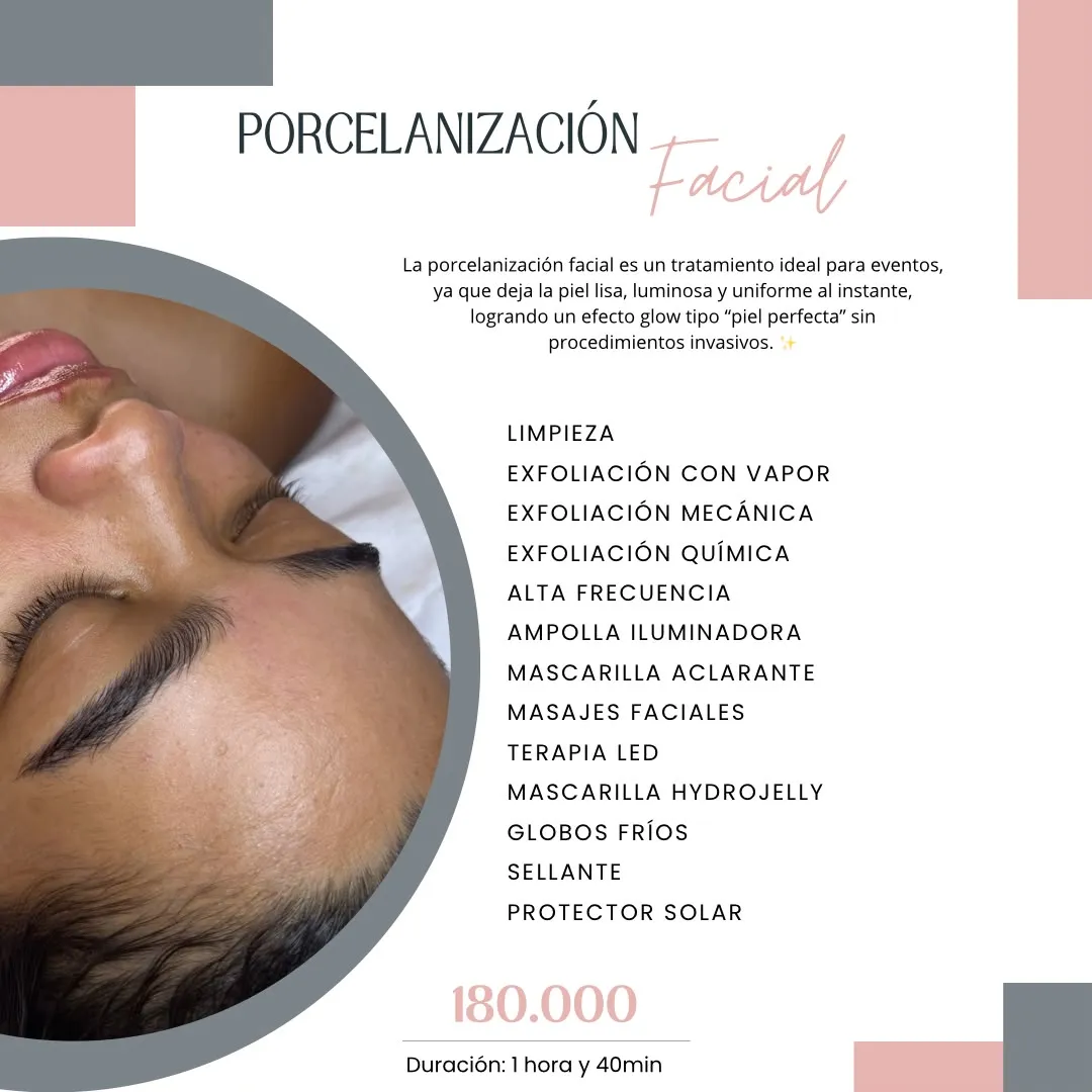 “Porcelanización